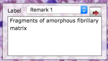 annotation